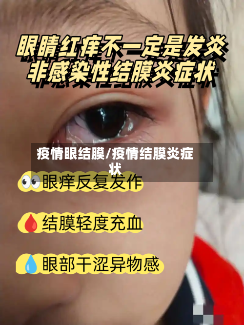 疫情眼结膜/疫情结膜炎症状-第2张图片