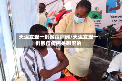 天津发现一例猴痘病例/天津发现一例猴痘病例是哪里的-第1张图片
